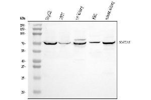 Western blot analysis of SLC5A1 using anti-SLC5A1 antibody (ABIN3042639).