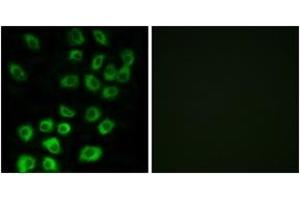 Immunofluorescence analysis of MCF7 cells, using ARFGAP1 Antibody. (ARFGAP1 抗体  (AA 171-220))
