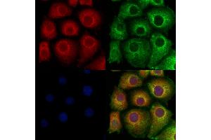 ABIN6260109 and ABIN6278114 staining Hela cells by IF/ICC. (ATG9A 抗体  (Internal Region))