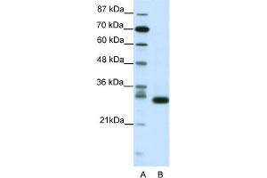 WB Suggested Anti-CDK5 Antibody Titration:  1. (CDK5 抗体  (N-Term))