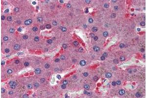 Human Liver: Formalin-Fixed, Paraffin-Embedded (FFPE) (CBS 抗体  (AA 1-101))