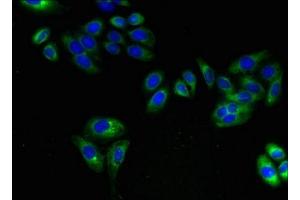 Immunofluorescent analysis of HepG2 cells using ABIN7143514 at dilution of 1:100 and Alexa Fluor 488-congugated AffiniPure Goat Anti-Rabbit IgG(H+L) (ARL6IP1 抗体  (AA 93-133))