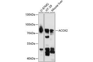 Western blot analysis of extracts of various cell lines, using  antibody (ABIN6130862, ABIN6136444, ABIN6136445 and ABIN6216549) at 1:3000 dilution. (Acox2 抗体  (AA 1-150))
