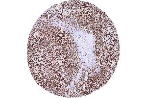 Lymph node showing a strong PARP1 staining of lymphocytic and other cells