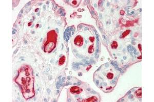 Human Placenta: Formalin-Fixed, Paraffin-Embedded (FFPE)