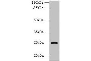 Western blot All lanes: RAB32 antibody at 3 μg/mL + Mouse kidney tissue Secondary Goat polyclonal to rabbit IgG at 1/10000 dilution Predicted band size: 25 kDa Observed band size: 25 kDa (RAB32 抗体  (AA 2-225))