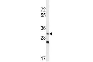 Western Blotting (WB) image for anti-Wingless-Type MMTV Integration Site Family, Member 3A (WNT3A) (AA 151-180) antibody (ABIN3029629)