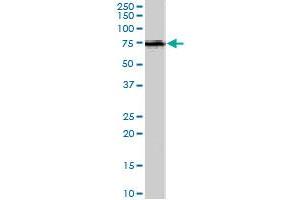 ACSL5 polyclonal antibody  (1 ug/mL) staining of human spleen lysate (35 ug protein in RIPA buffer). (ACSL5 抗体)