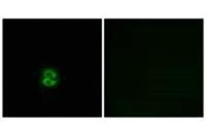 Immunofluorescence analysis of A549 cells, using CHST6 antibody. (CHST6 抗体)