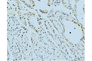 IHC analysis of TBP-1/PSMC3 using anti-TBP-1/PSMC3 antibody (ABIN7599392).