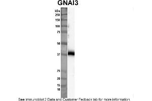 Sample Type: Nthy-ori cell lysate (50ug)Primary Dilution: 1:1000Secondary Antibody: anti-rabbit HRPSecondary Dilution: 1:2000Image Submitted By: Anonymous (GNAI3 抗体  (Middle Region))