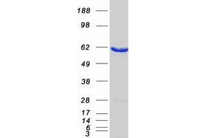 Western Blotting (WB) image for Methylcrotonoyl-CoA Carboxylase 2 (Beta) (MCCC2) protein (Myc-DYKDDDDK Tag) (ABIN2725599)