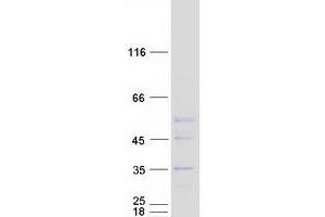 Western Blotting (WB) image for Elongator Acetyltransferase Complex Subunit 6 (ELP6) protein (Myc-DYKDDDDK Tag) (ABIN2714125)