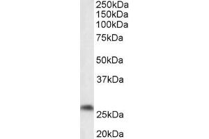 Western Blotting (WB) image for anti-Prostaglandin D2 Synthase (PTGDS) (Internal Region) antibody (ABIN987281)