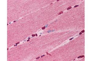 Anti-TIRAP antibody IHC of human skeletal muscle.