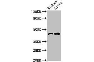 Western Blot Positive WB detected in: Mouse kidney tissue, Mouse liver tissue All lanes: BLZF1 antibody at 3 μg/mL Secondary Goat polyclonal to rabbit IgG at 1/50000 dilution Predicted band size: 45, 20 kDa Observed band size: 45 kDa (BLZF1 抗体  (AA 11-99))