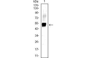 Western blot analysis using KRT13 mouse mAb against A431 (1) cell lysate. (Cytokeratin 13 抗体  (AA 104-458))