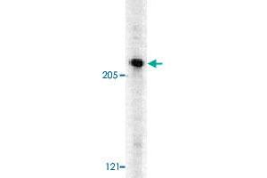 Western blot analysis of CASP8AP2 in HeLa whole cell lysates with CASP8AP2 polyclonal antibody  at 0. (FLASH 抗体  (C-Term))