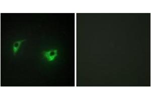 Immunofluorescence analysis of A549 cells, using MEKKK 4 Antibody. (MAP4K4 抗体  (AA 406-455))