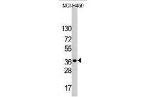 Western blot analysis of LDLRAP1 polyclonal antibody  in NCI-H460 cell line lysates (35 ug/lane). (LDLRAP1 抗体  (C-Term))