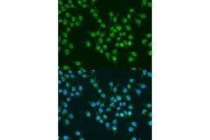 Immunofluorescence analysis of U2OS cells using KLF4 antibody. (KLF4 抗体  (AA 180-479))