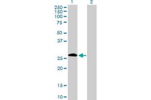 Western Blot analysis of IGSF6 expression in transfected 293T cell line by IGSF6 MaxPab polyclonal antibody. (IGSF6 抗体  (AA 1-241))