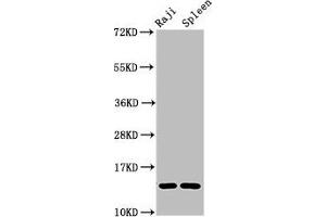 Western Blot Positive WB detected in: Raji whole cell lysate, Rat spleen tissue All lanes: GABARAPL2 antibody at 4 μg/mL Secondary Goat polyclonal to rabbit IgG at 1/50000 dilution Predicted band size: 14 kDa Observed band size: 14 kDa (GABARAPL2 抗体  (AA 1-117))