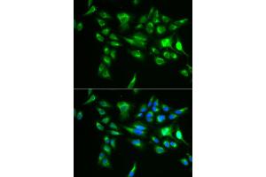 Immunofluorescence analysis of U2OS cell using POLG2 antibody. (POLG2 抗体)