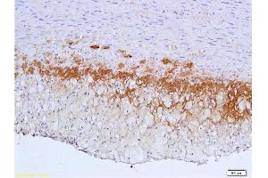 Formalin-fixed and paraffin embedded: rabbit carotid artery labeled with Anti-TGF-beta-R2/TGFBR2 Polyclonal Antibody , Unconjugated 1:600 followed by conjugation to the secondary antibody and DAB staining (TGFBR2 抗体  (AA 241-330))