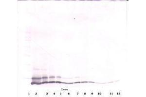 Image no. 3 for anti-Chemokine (C-X-C Motif) Ligand 1 (Melanoma Growth Stimulating Activity, Alpha) (CXCL1) antibody (ABIN465459)