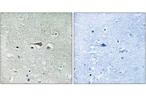 Immunohistochemistry analysis of paraffin-embedded human brain tissue, using TTK (Ab-676) Antibody. (Mps1 抗体  (AA 642-691))