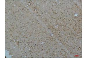 Immunohistochemistry (IHC) analysis of paraffin-embedded Rat Brain Tissue using Cav pan alpha1Rabbit Polyclonal Antibody diluted at 1:200. (Cav Pan Alpha1 (pan) 抗体)