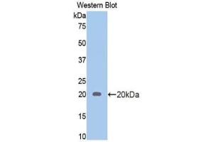 Western blot analysis of the recombinant protein. (Androgen Receptor 抗体  (AA 765-902))