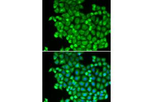 Immunofluorescence analysis of A549 cells using LDHA antibody (ABIN5970494). (Lactate Dehydrogenase A 抗体)