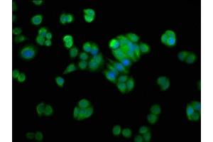 Immunofluorescence staining of PC-3 cells with ABIN7161661 at 1:200, counter-stained with DAPI. (NMRAL1 抗体  (AA 1-299))