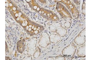 Immunoperoxidase of monoclonal antibody to CDC42BPB on formalin-fixed paraffin-embedded human small Intestine. (CDC42BPB 抗体  (AA 1580-1679))