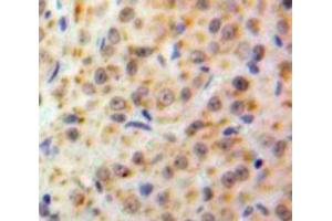 IHC-P analysis of Ovary tissue, with DAB staining. (NUP50 抗体  (AA 134-393))