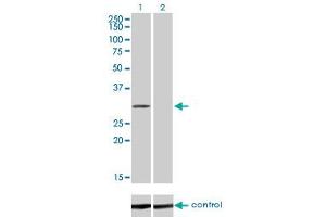 Western blot analysis of COASY over-expressed 293 cell line, cotransfected with COASY Validated Chimera RNAi (Lane 2) or non-transfected control (Lane 1). (COASY 抗体  (AA 1-225))