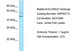 Western Blotting (WB) image for anti-CWC27 Spliceosome-Associated Protein Homolog (Cwc27) (C-Term) antibody (ABIN2788570)
