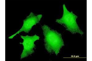 Immunofluorescence of monoclonal antibody to CASP2 on HeLa cell. (Caspase 2 抗体  (AA 121-220))