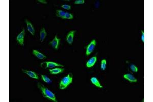 Immunofluorescence staining of Hela cells with ABIN7145178 at 1:400, counter-stained with DAPI. (BCAP31 抗体  (AA 2-243))