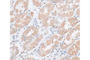Immunohistochemistry of paraffin-embedded Human stomach using PAEP Polyclonal Antibody at dilution of 1:100 (40x lens). (PAEP 抗体)