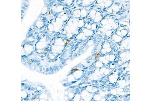 Immunohistochemistry of paraffin embedded mouse colon using IL34 (ABIN7074359) at dilution of 1:900 (400x lens) (IL-34 抗体)