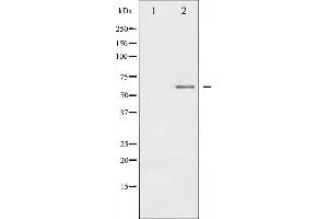 Western blot analysis of IL-10R alpha phosphorylation expression in HuvEc whole cell lysates,The lane on the left is treated with the antigen-specific peptide. (IL-10RA 抗体  (pTyr496))