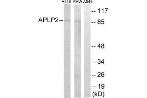 Western Blotting (WB) image for anti-Amyloid beta (A4) Precursor-Like Protein 2 (APLP2) (Internal Region) antibody (ABIN1850752) (APLP2 抗体  (Internal Region))
