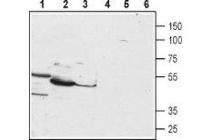 Western blot analysis of HepG2 (lanes 1 and 4), mouse liver (lanes 2 and 5) and rat liver (lanes 3 and 6) lysates: - 1-3. (PTH1R 抗体  (1st Extracellular Loop))