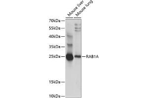 Western blot analysis of extracts of various cell lines, using RA antibody (ABIN7269797) at 1:1000 dilution. (RAB1A 抗体  (AA 1-100))