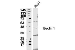 293T lyates probed with Rabbit Anti-Beclin 1 Polyclonal Antibody, Unconjugated  at 1:300 in 4˚C overnight. (Beclin 1 抗体  (AA 201-330))