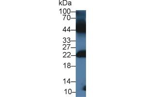 Detection of GREM1 in Mouse Testis lysate using Polyclonal Antibody to Gremlin 1 (GREM1) (GREM1 抗体  (AA 27-184))