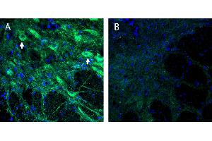 anti-Anoctamin 1, Calcium Activated Chloride Channel (ANO1) (3rd Extracellular Loop), (AA 679-694) antibody
